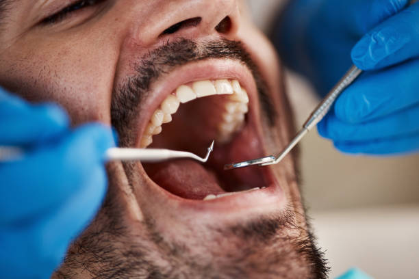 Emergency Dental Services in Buna, TX